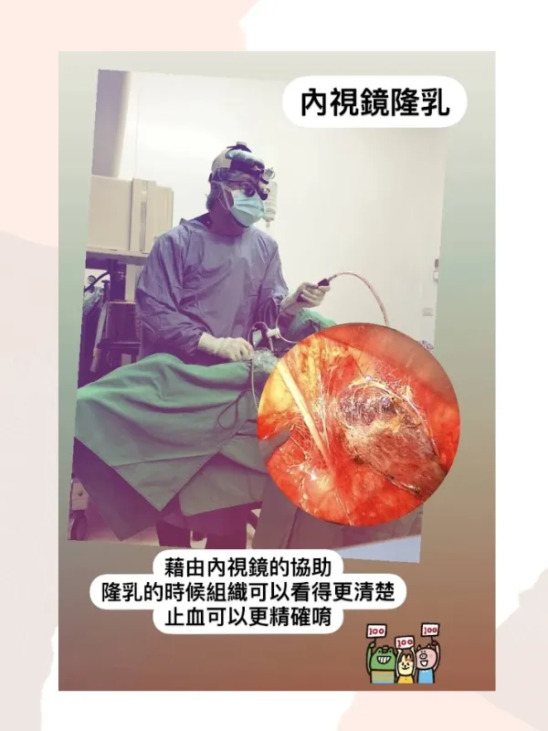 高雄內視鏡隆乳